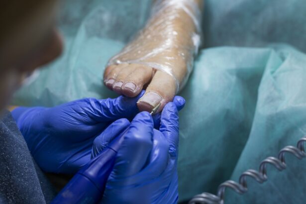 How Ingrown Toenails Can Affect Your Overall Foot Health