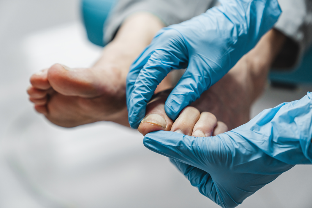 The Role of Podiatrists in Foot Surgery