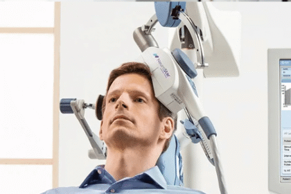 The Role of TMS Therapy in the Treatment of Bipolar Disorder