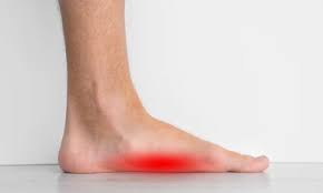 Understanding the Latest Treatments for Plantar Fasciitis