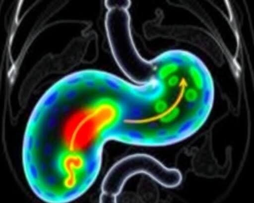Exploring Advances in Pancreatic Cancer Treatment
