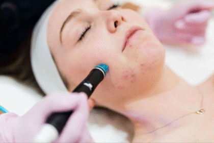 Hydrafacial Frequency for Optimal Skin Health