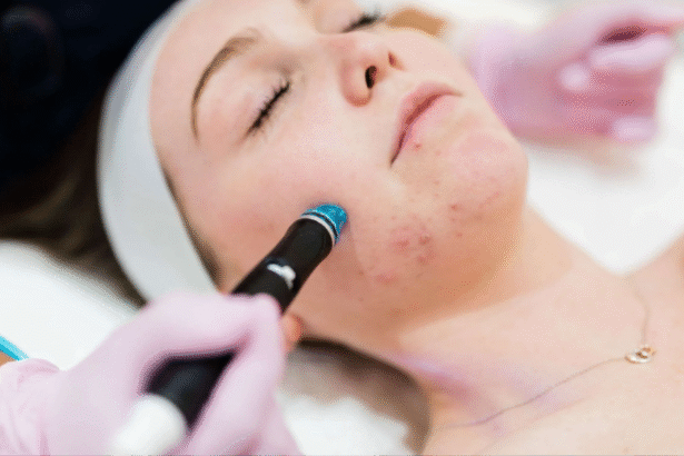 Hydrafacial Frequency for Optimal Skin Health