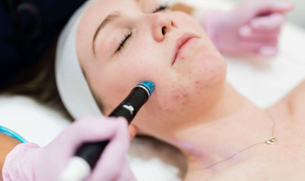 Hydrafacial Frequency for Optimal Skin Health