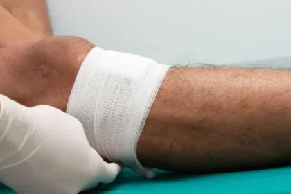 Key Tips for Effective Wound Care