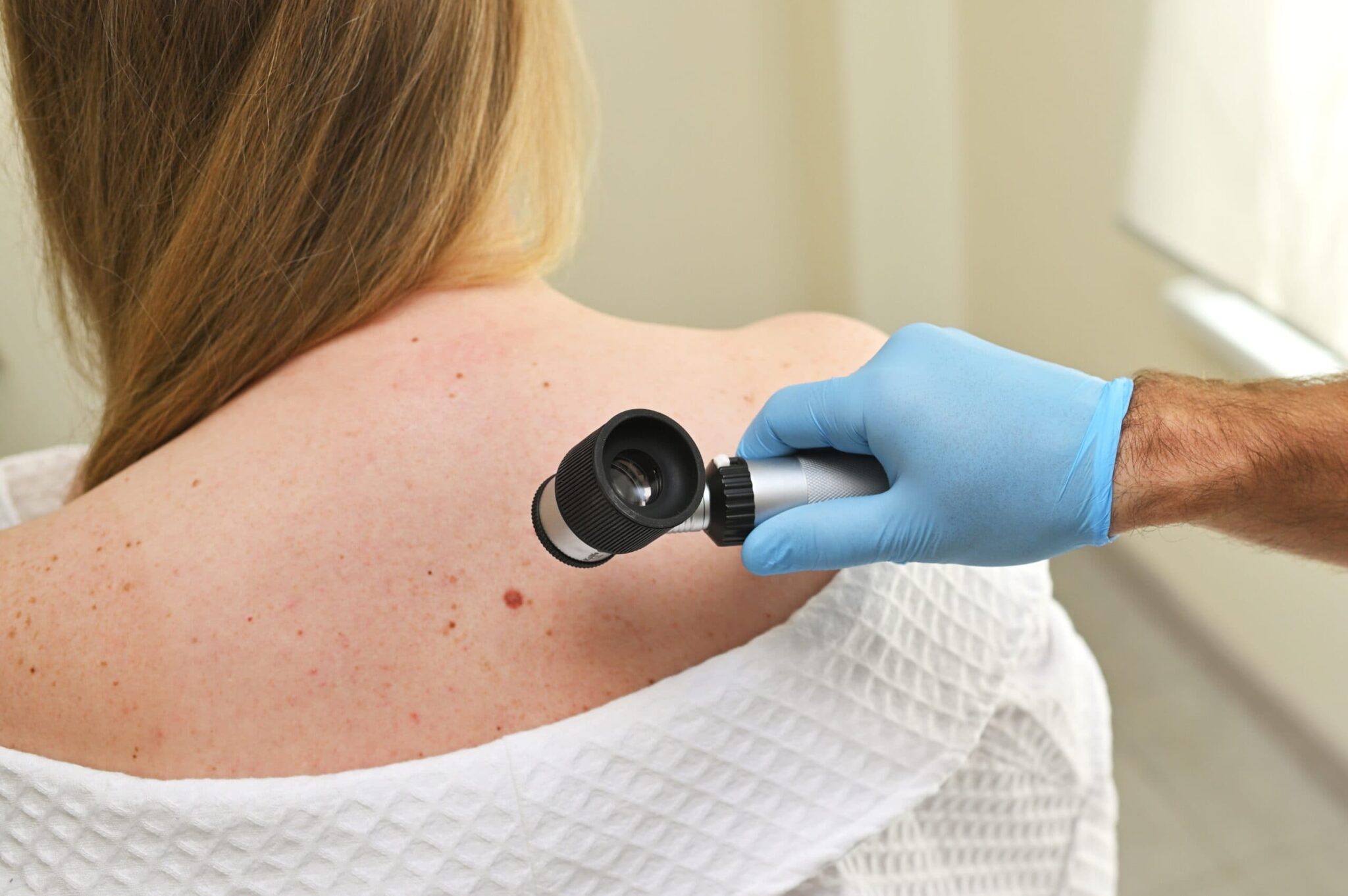 The Role of a Melanoma Dermatologist in Early Detection