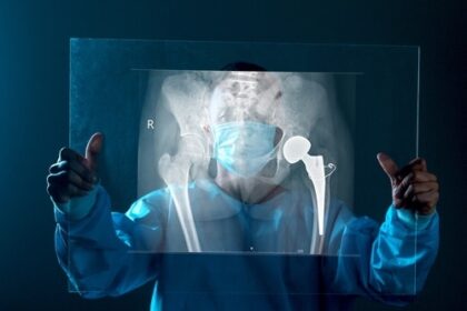 Understanding the Recovery Process After Hip Replacement Surgery