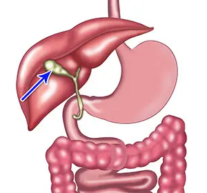 Exploring the Symptoms of Gallbladder Disease