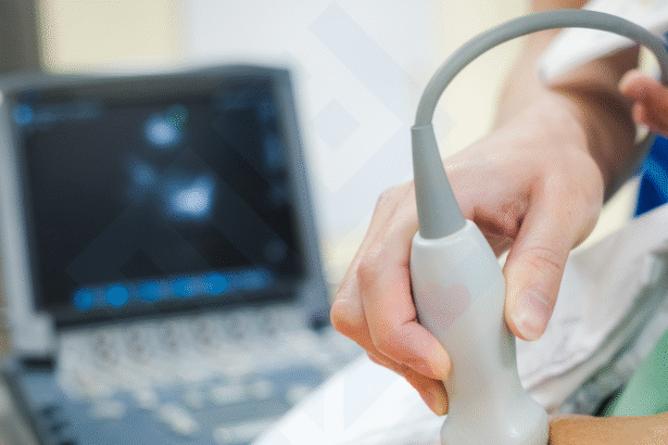 FAQs About Cardiology