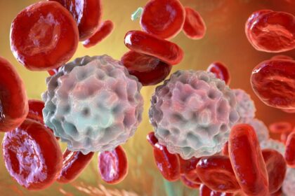 Signs and Treatment Solutions for IBD
