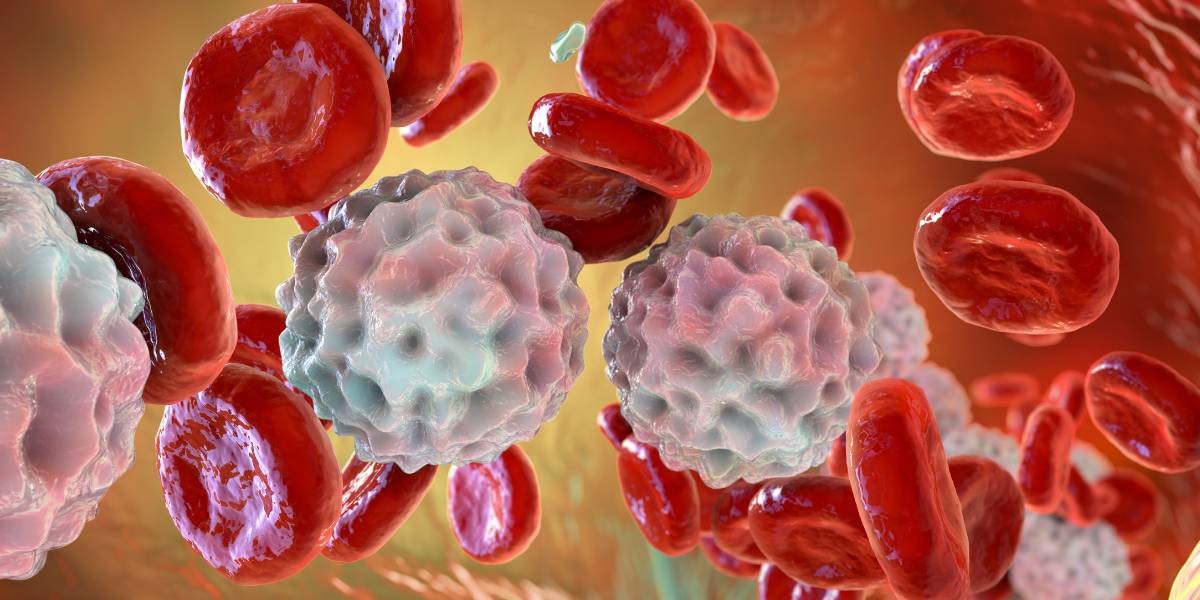 Signs and Treatment Solutions for IBD