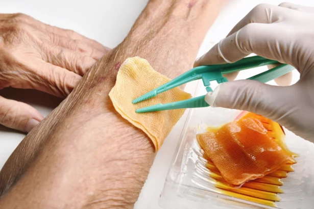 The Role of Nutrition in Promoting Wound Healing