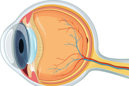Understanding the Process Involved in Cataract Surgery