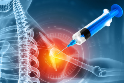 What to Know About Prolotherapy