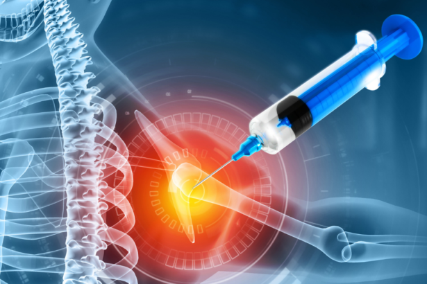 What to Know About Prolotherapy