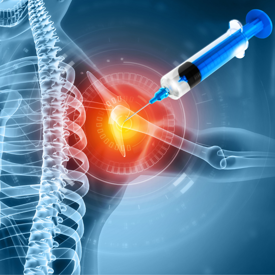 What to Know About Prolotherapy